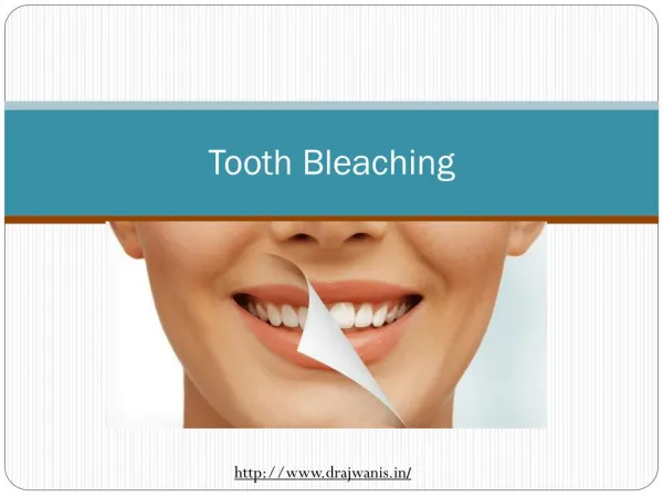 Overview of Tooth Bleaching by Pune’s Best Dentist – Dr Ajwani