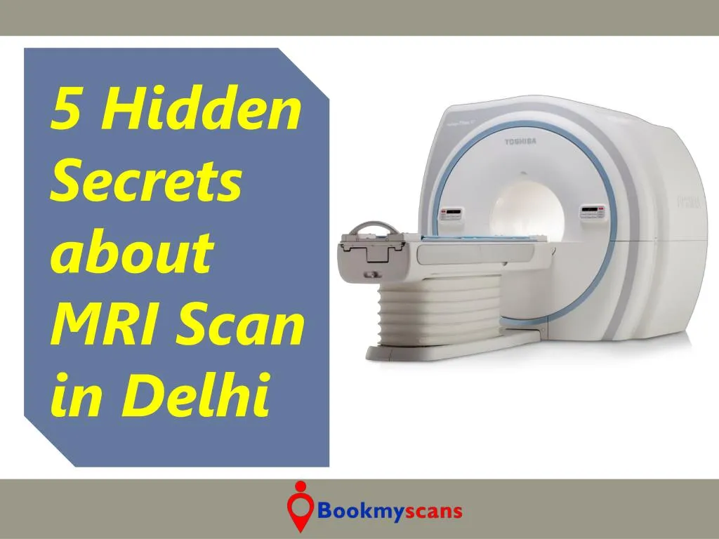 5 hidden secrets about mri scan in delhi