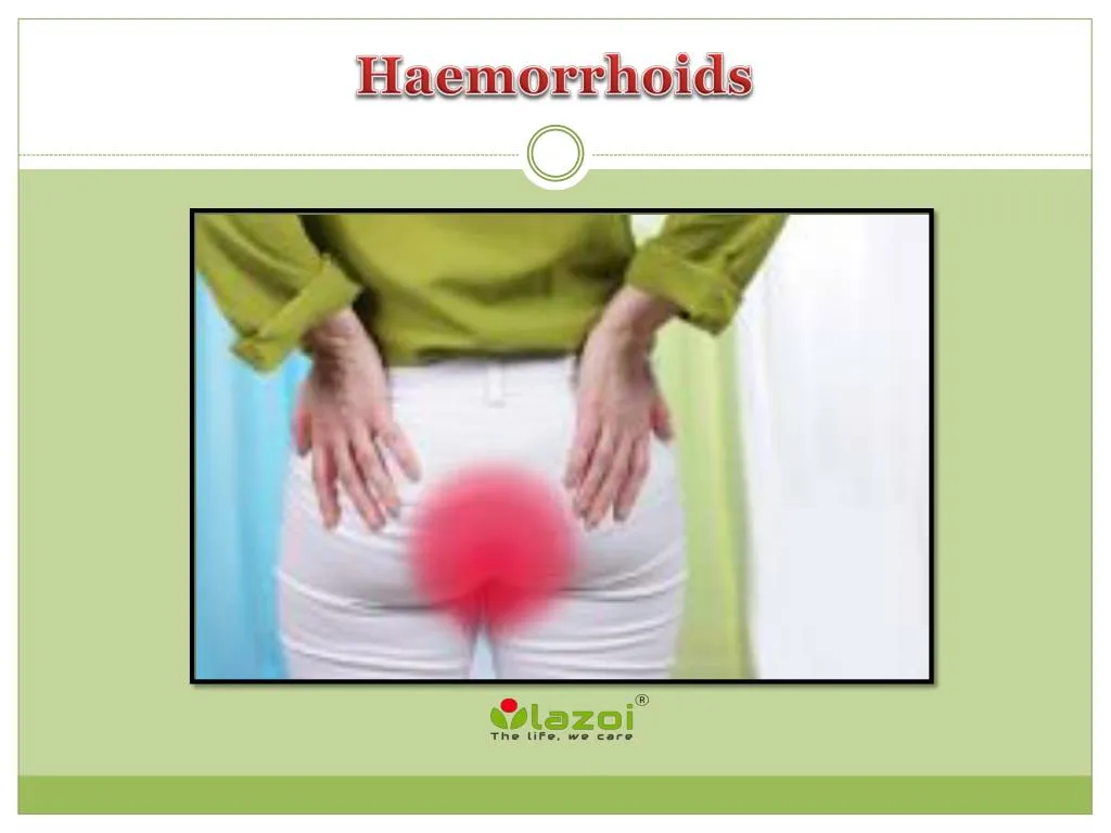 Ppt Haemorrhoids Symptoms Causes Diagnosis And Treatment Powerpoint Presentation Id7667276 