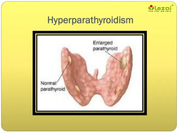 Hyperparathyroidism: Symptoms, causes and treatment
