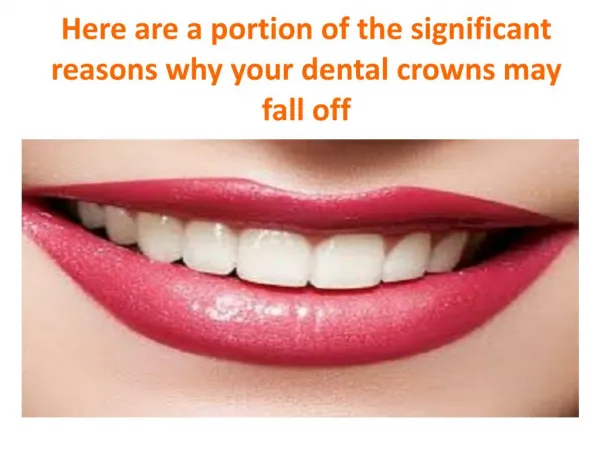 Here are a portion of the significant reasons why your crowns may fall off