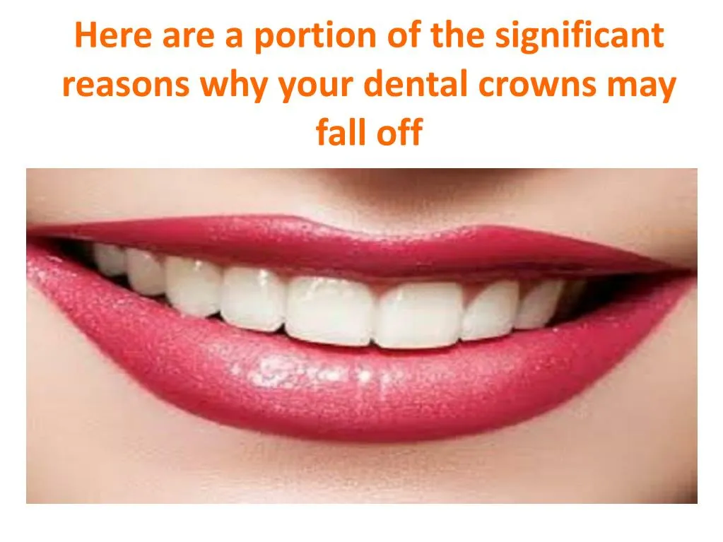 here are a portion of the significant reasons why your dental crowns may fall off