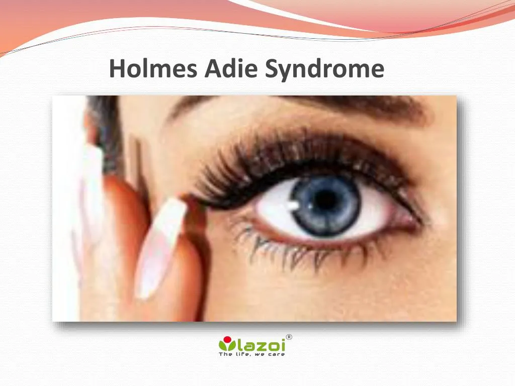 holmes adie syndrome