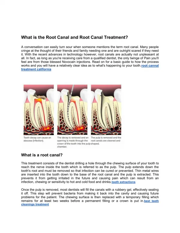 What is the Root Canal and Root Canal Treatment?