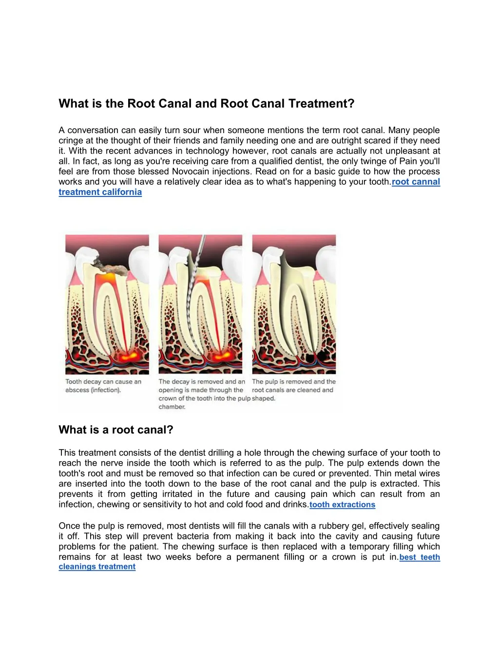 what is the root canal and root canal treatment