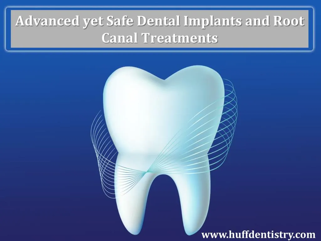 advanced yet safe dental implants and root canal treatments
