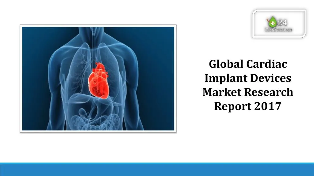 global cardiac implant devices market research