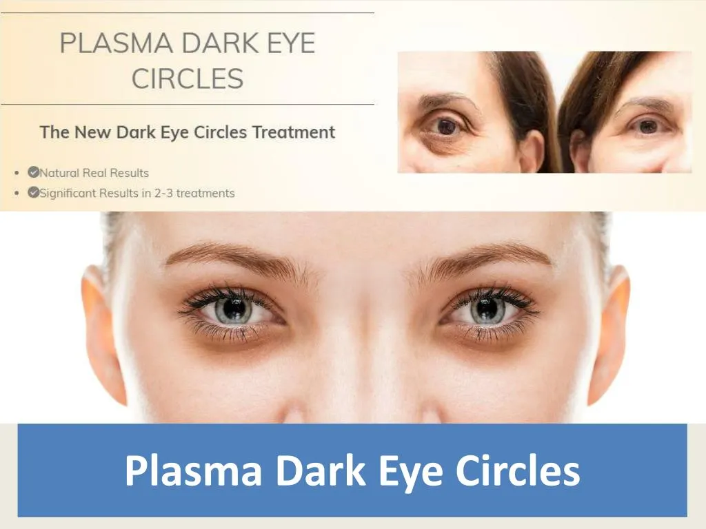 plasma dark eye circles