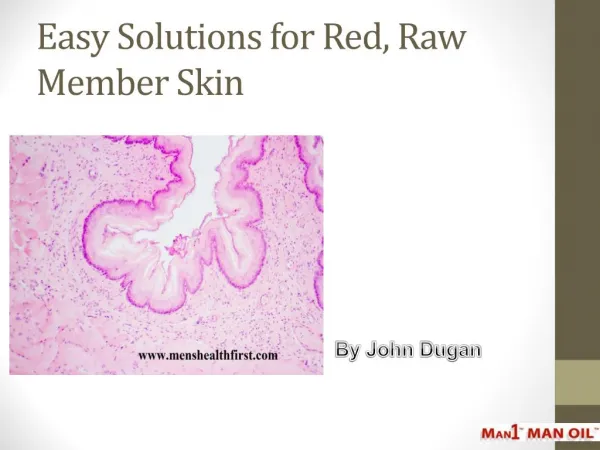 Easy Solutions for Red, Raw Member Skin