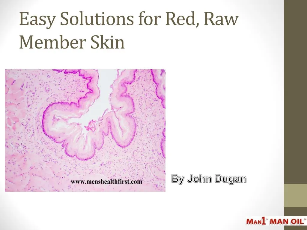 easy solutions for red raw member skin