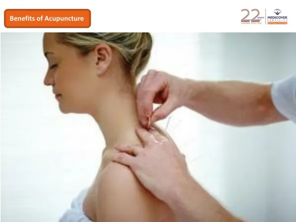Benefits of acupuncture for stress reduction