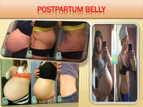 Postpartum Belly