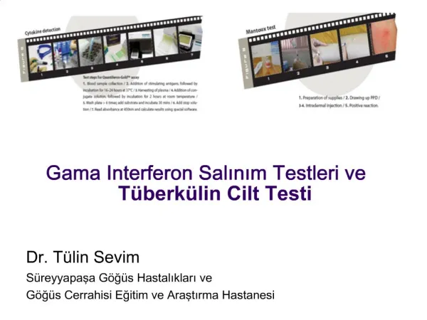 Gama Interferon Salinim Testleri ve T berk lin Cilt Testi
