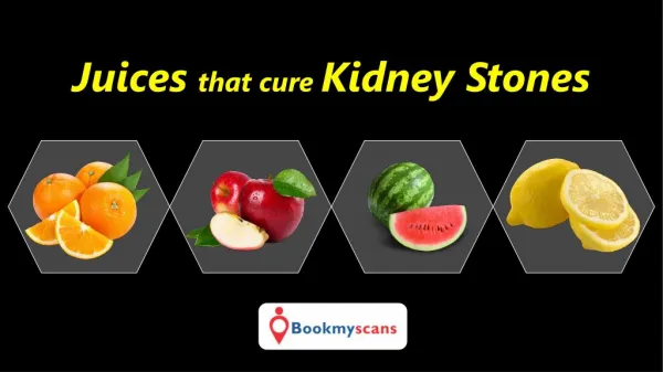 Stay Healthy!- Reduce kidney stones with these Juices - BookMyScans