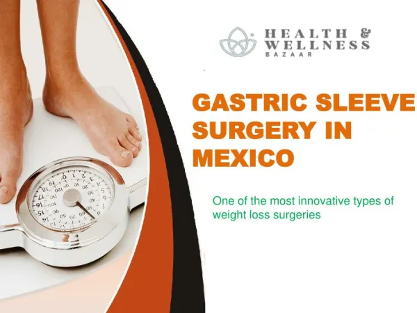 Gastric sleeve surgery in Mexico - Best Choices of patients