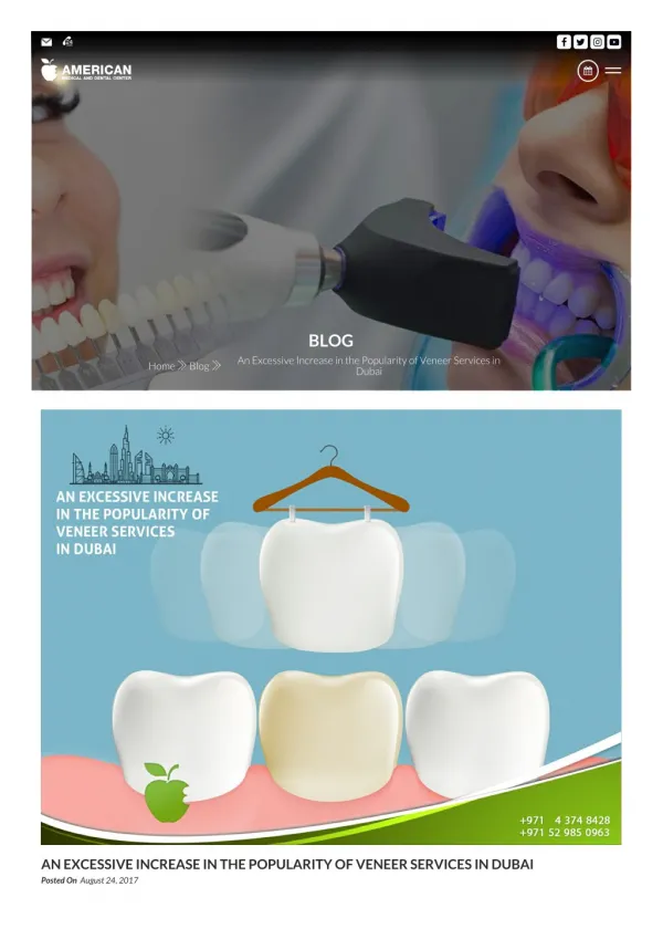 Veneers in Dubai | Dentist in Dubai |Dental clinic in dubai