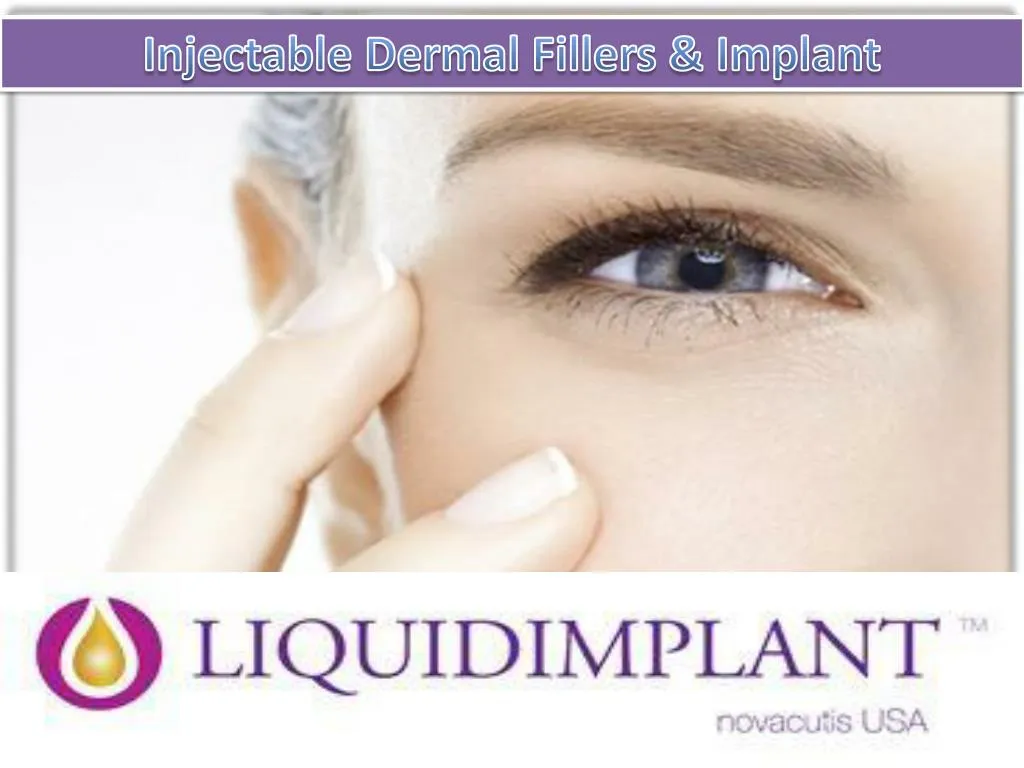 injectable dermal fillers implant