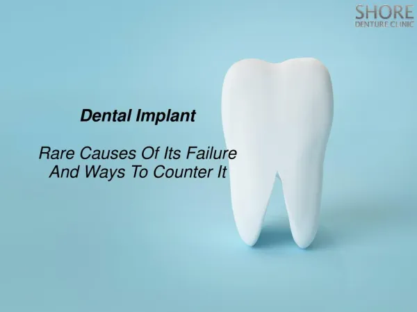 Dental Implant: Rare Causes Of Its Failure And Ways To Counter It