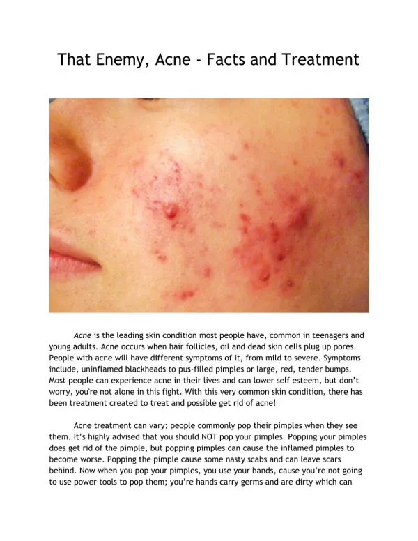 That Enemy, Acne - Facts and Treatment