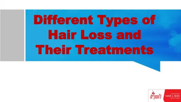 Different Types of Hair Loss and Their Treatments