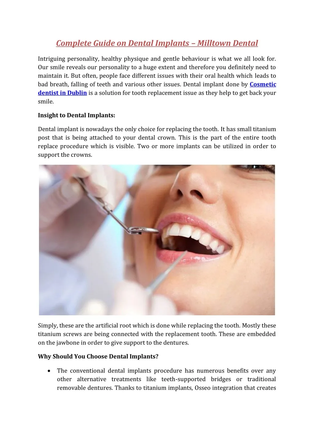 complete guide on dental implants milltown dental