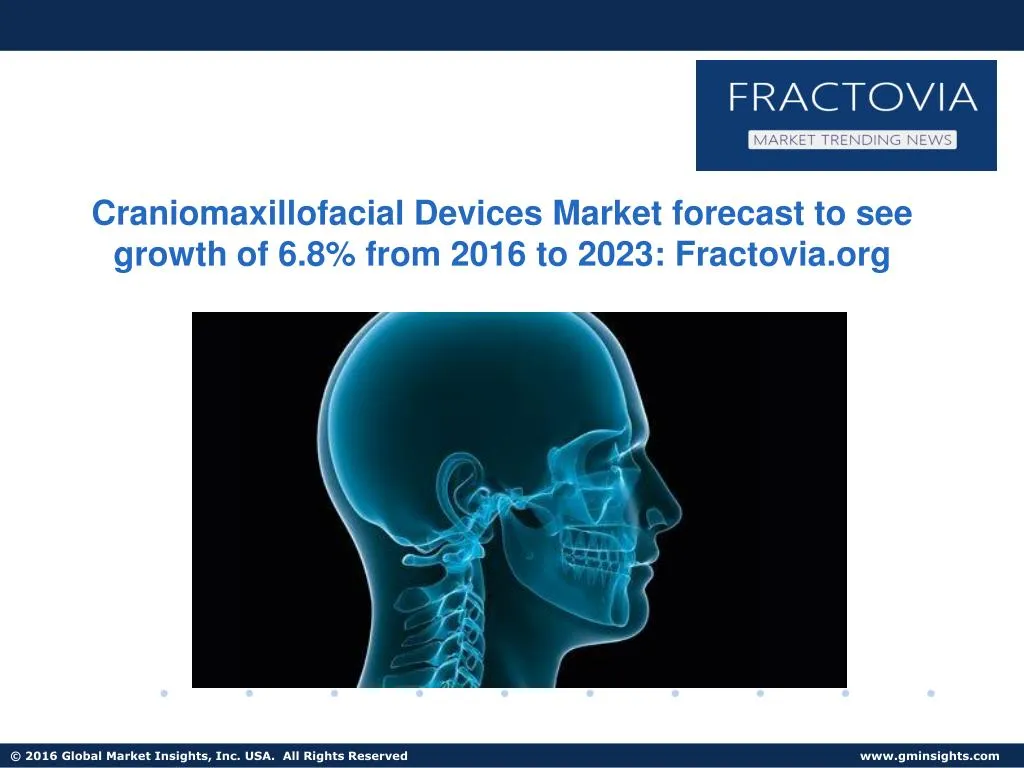 craniomaxillofacial devices market forecast