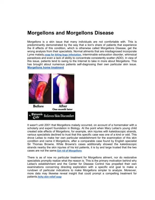 Morgellons and Morgellons Disease