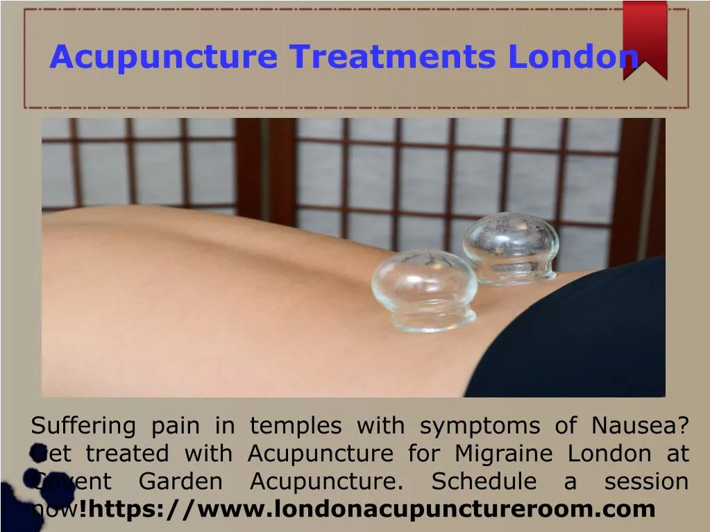 acupuncture treatments london