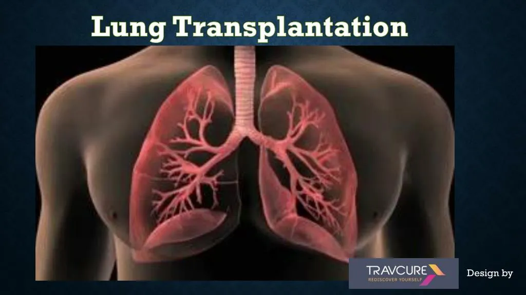 lung transplantation