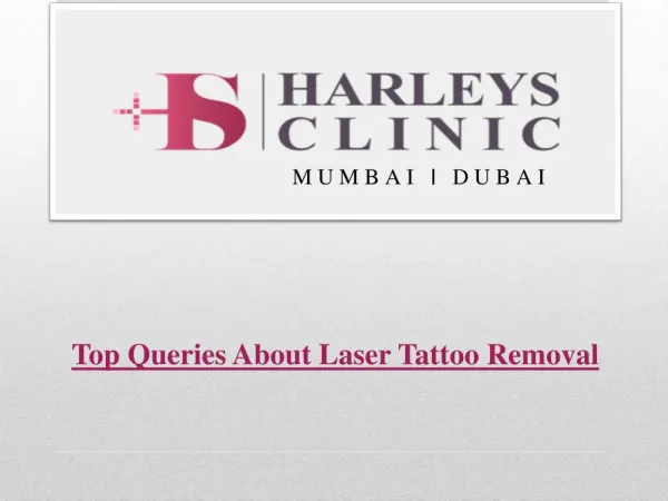 Top Queries About Laser Tattoo Removal