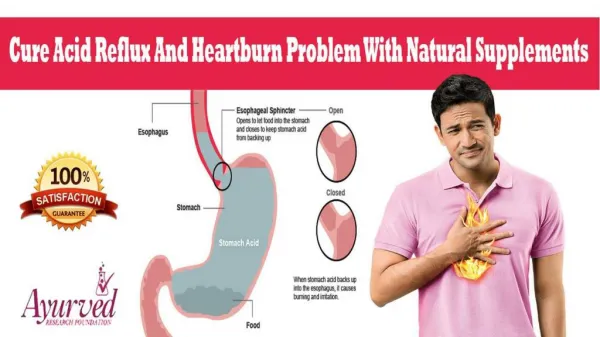 Cure Acid Reflux And Heartburn Problem With Natural Supplements
