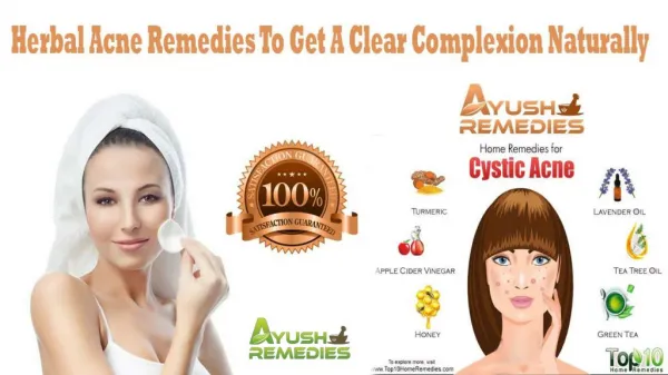Herbal Acne Remedies To Get A Clear Complexion Naturally