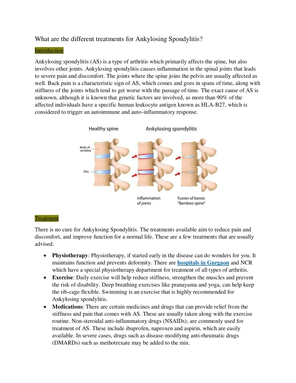 what are the different treatments for ankylosing