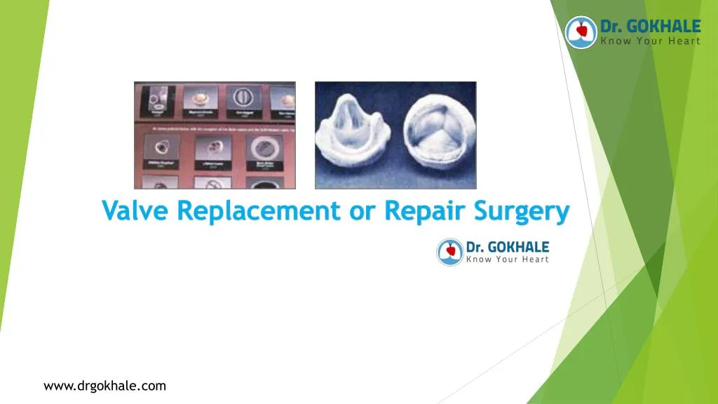 valve replacement or repair surgery