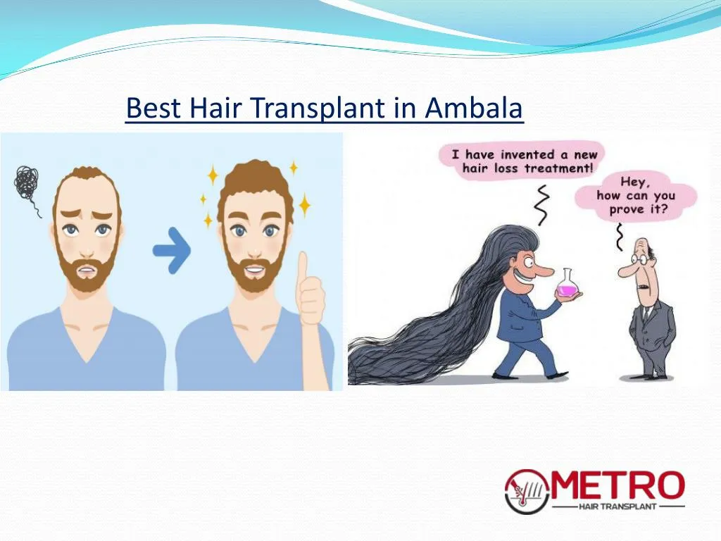 best hair transplant in ambala