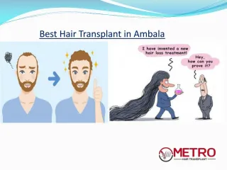 Best Hair Transplant in Ambala | Metro Hair Transplant Clinic