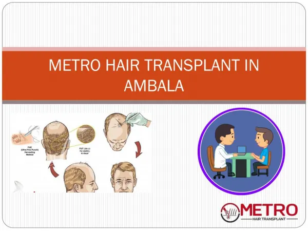 Metro Hair Transplant in Ambala