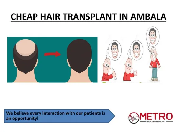 Cheap Hair transplant in Ambala