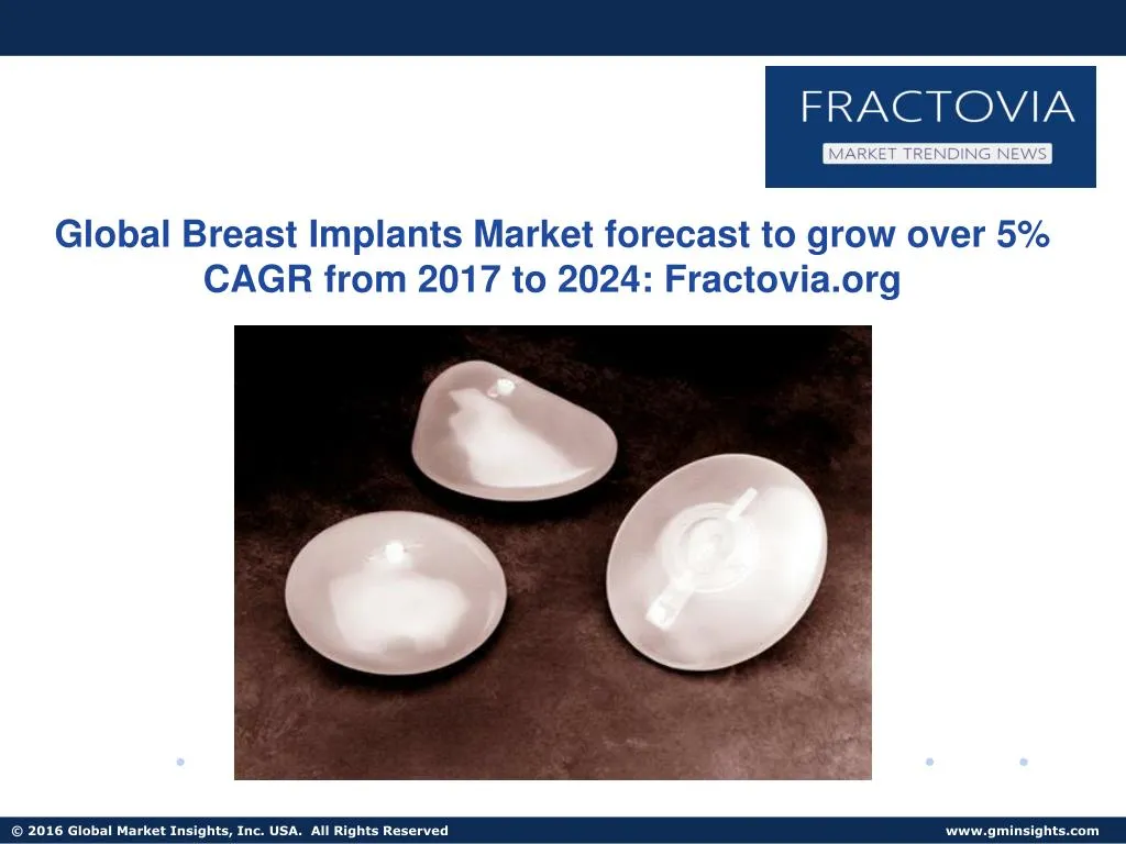 global breast implants market forecast to grow
