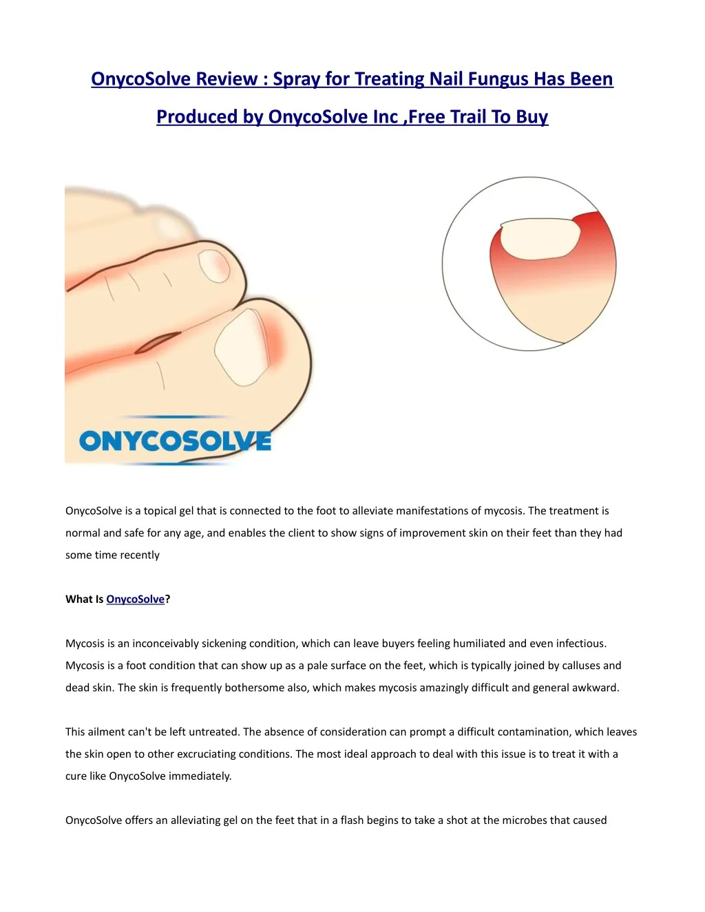 onycosolve review spray for treating nail fungus