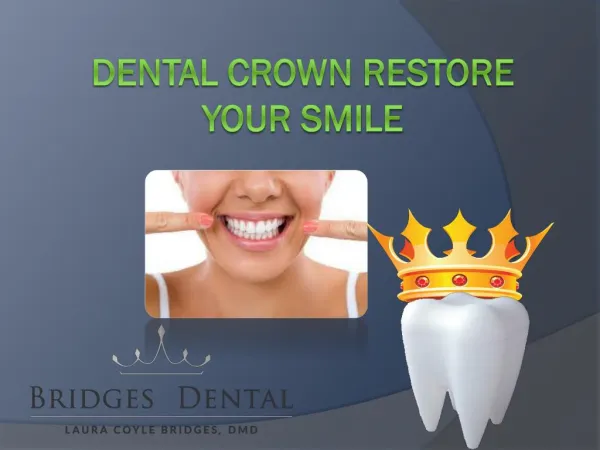 Lithia Dentist: Denal Crown can Restore Your Smile | Bridges Dental