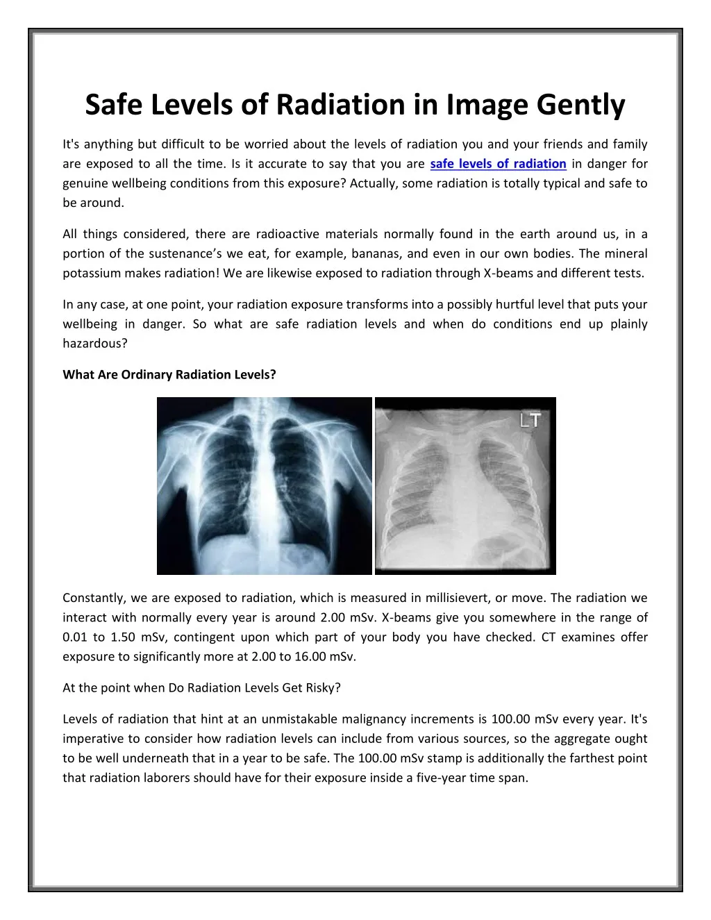 safe levels of radiation in image gently