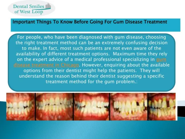 Important Things To Know Before Going For Gum Disease Treatment