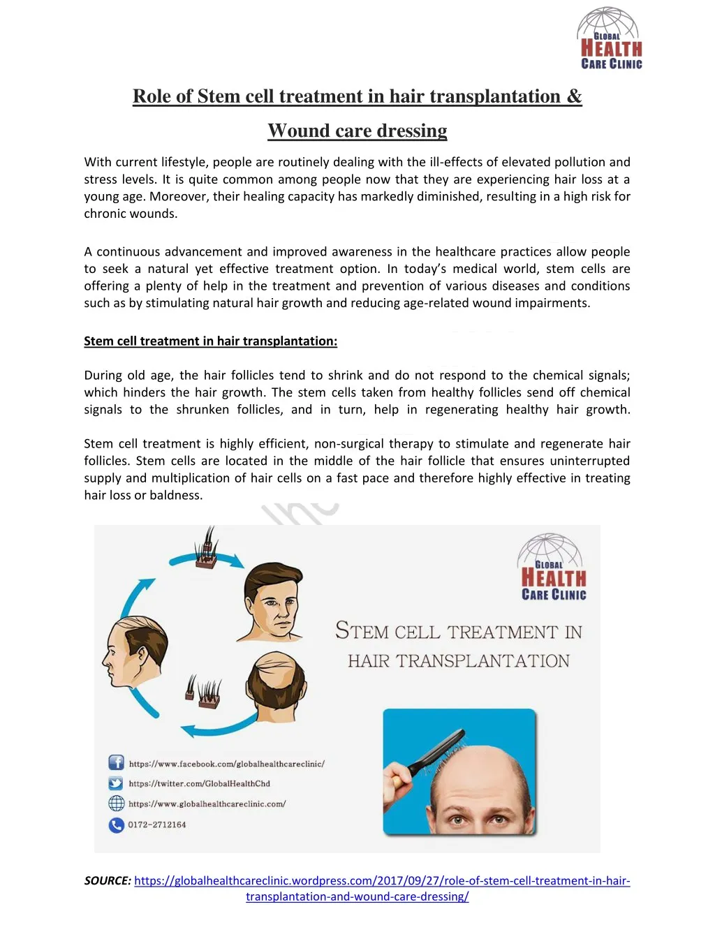 role of stem cell treatment in hair