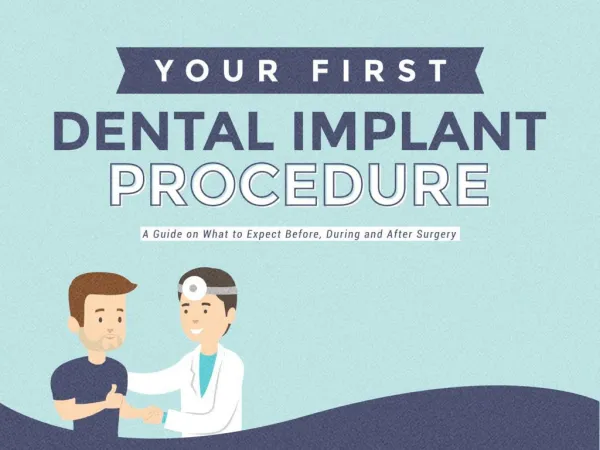 Your First Dental Implant Procedure