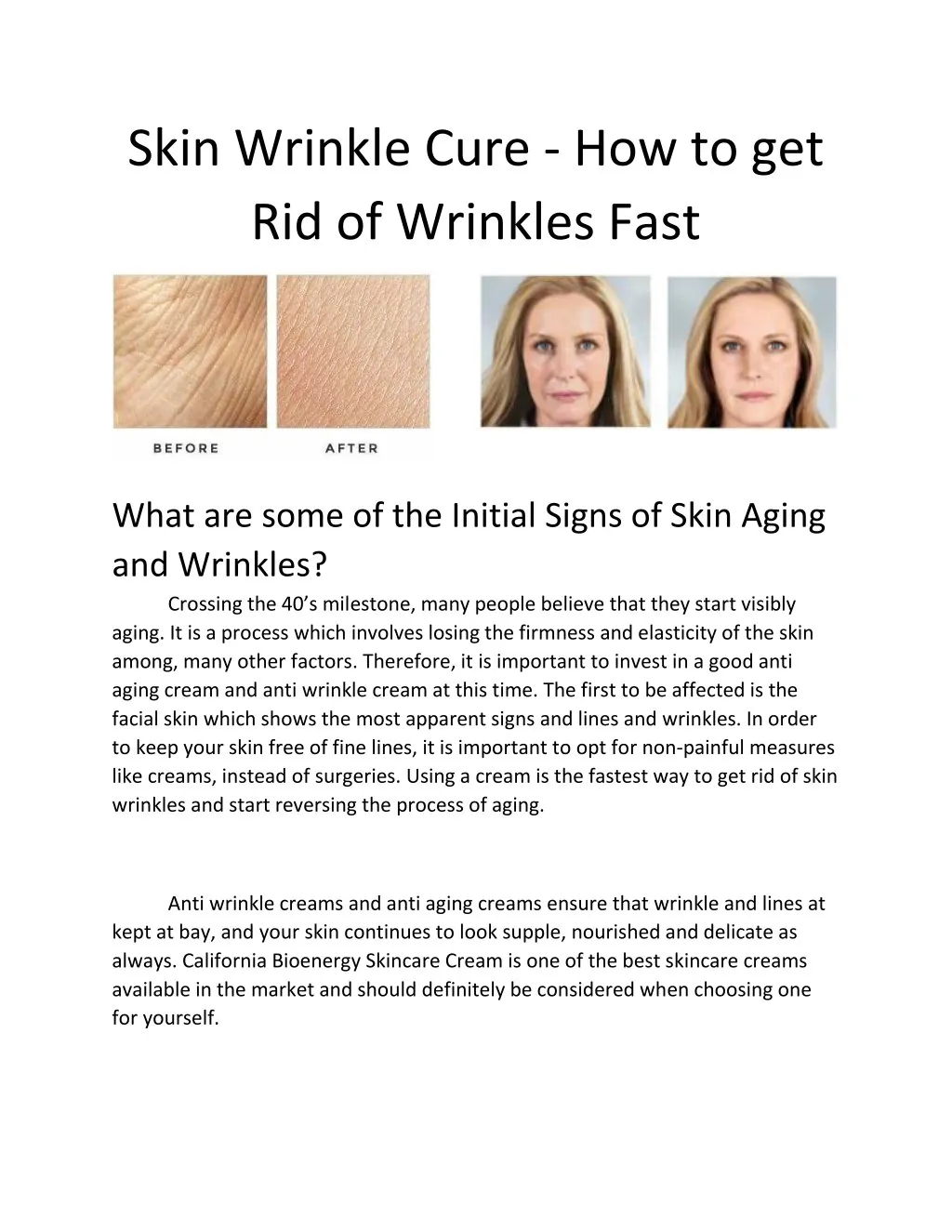 skin wrinkle cure how to get rid of wrinkles fast