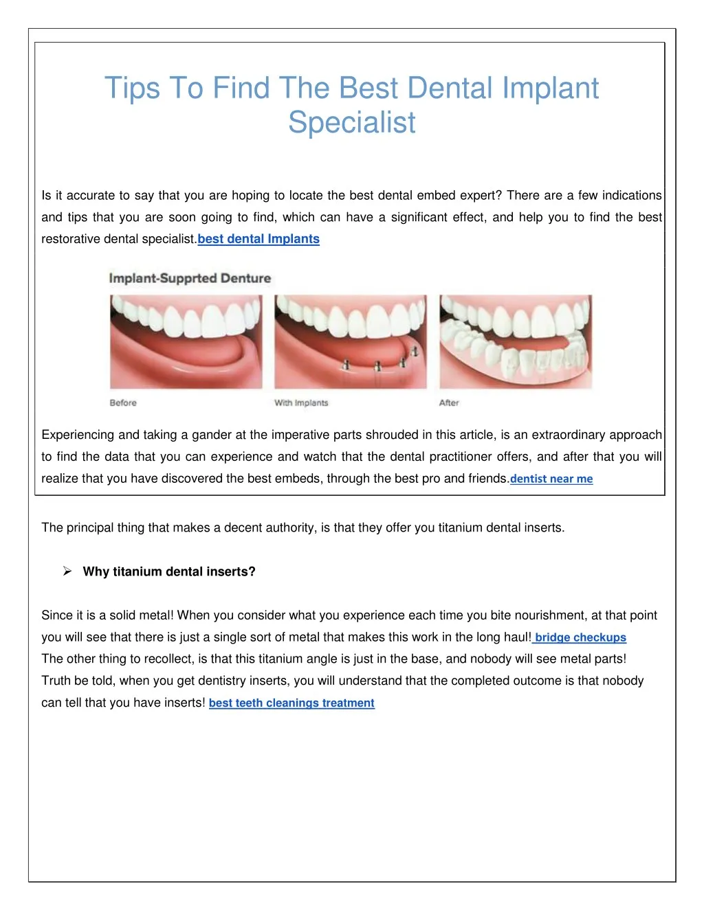 tips to find the best dental implant specialist