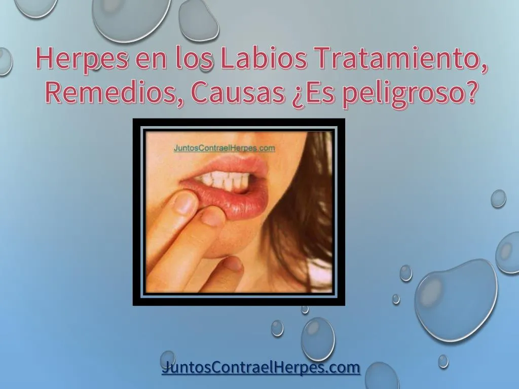 herpes en los labios tratamiento remedios causas es peligroso