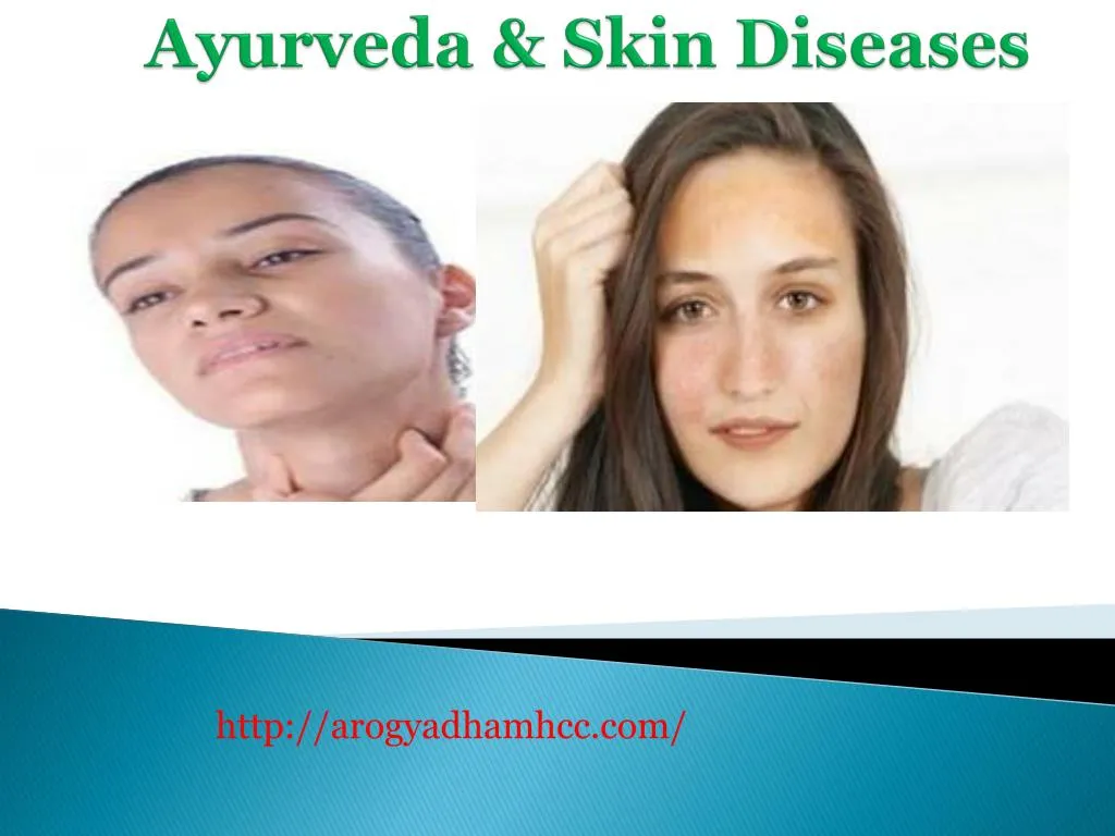 ayurveda skin diseases