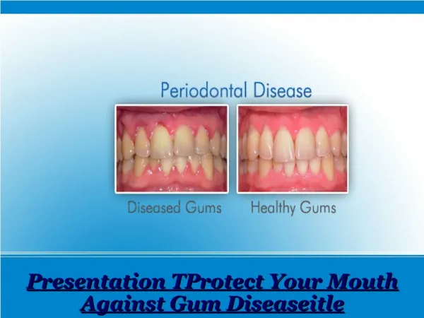 Protect Your Mouth Against Gum Disease